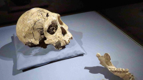 Photo showing a skull and jaw bone laid out on a table